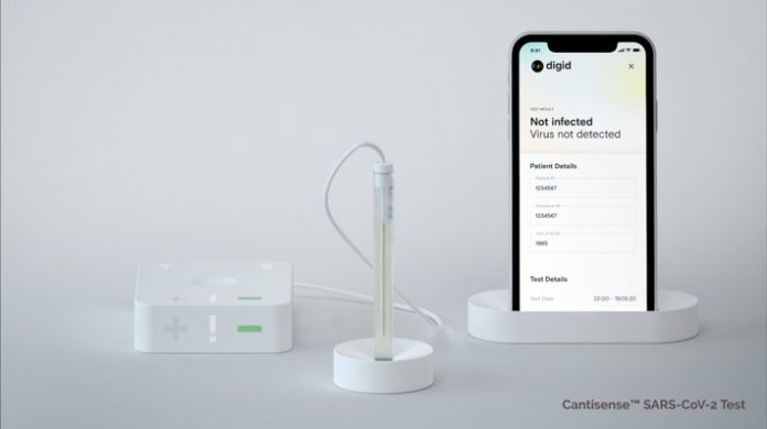 Das Gesundheitstechnologie-Unternehmen Digital Diagnostics AG hat beim Bundesinstitut für Arzneimittel und Medizinprodukte (BfArM) die Zulassung des Digid Cantisense(TM) SARS-CoV-2 Tests für Deutschland beantragt. Mit dem neuen Test können am Point-of-Care in wenigen Minuten SARS-CoV-2 Viren mit hoher Messgenauigkeit direkt in Testflüssigkeiten nachgewiesen werden. Digid Point-of-care test kit: sensor hub, biosensor, mobile device (Prototyp/Copyright: Digital Diagnostics AG). Weiterer Text über ots und www.presseportal.de/nr/144961 / Die Verwendung dieses Bildes ist für redaktionelle Zwecke honorarfrei. Veröffentlichung bitte unter Quellenangabe: